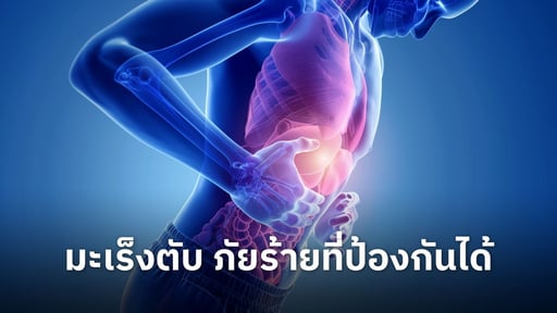 มะเร็งตับ ต้นเหตุทำให้คนไทยตายเป็นอันดับหนึ่ง ป้องกันได้ถ้ารู้แต่เนิ่นๆ